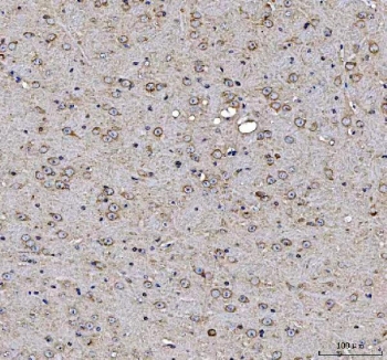 IHC staining of FFPE mouse brain tissue with MAP1S antibody. HIER: boil tissue sections in pH8 EDTA for 20 min and allow to cool before testing.