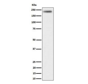 Western blot testing of human HeLa cell lysate with DENN antibody. Predicted molecular weight ~176 kDa.