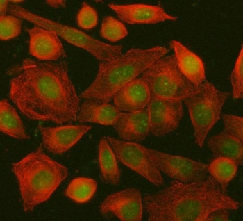 Immunofluorescent staining of FFPE human SiHa cells with ING5 antibody (green) and Beta Tubulin mAb (red). HIER: steam section in pH6 citrate buffer for 20 min.