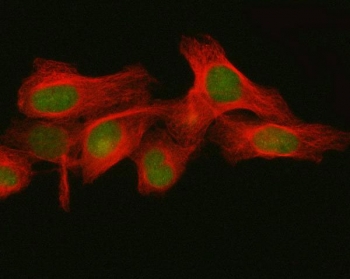 Immunofluorescent staining of FFPE human HeLa cells with FBXO32 antibody (green) and Beta Tubulin mAb (red). HIER: steam section in pH6 citrate buffer for 20 min.