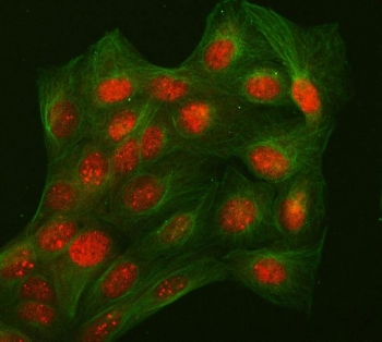 Immunofluorescent staining of FFPE human U-2 OS cells with L3MBTL2 antibody (red) and Beta Tubulin mAb (green). HIER: steam section in pH6 citrate buffer for 20 min.