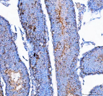 IHC staining of FFPE mouse testis tissue with CMG-1 antibody. HIER: boil tissue sections in pH8 EDTA for 20 min and allow to cool before testing.