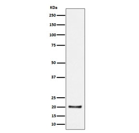 Western blot testing of human HepG2 cell lysate with COPS8 antibody. Predicted molecular weight ~23 kDa and ~18 kDa (two isoforms).