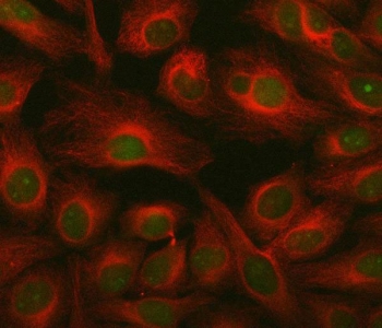 Immunofluorescent staining of FFPE human HeLa cells with ING2 antibody (green) and Beta Tubulin mAb (red). HIER: steam section in pH6 citrate buffer for 20 min.