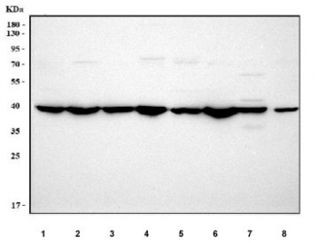 Western blot testing of 1) rat brain, 2) rat liver, 3) rat kidney, 4) rat RH35, 5) mouse brain, 6) mouse liver, 7) mouse kidney, 8) mouse NIH 3T3 cell lysate with LDAH antibody. Predicted molecular weight ~37 kDa.
