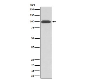Western blot testing of human U-87 MG cell lysate with Integrin beta 3 antibody. Predicted molecular weight ~88 kDa but may be observed at higher molecular weights due to glycosylation.