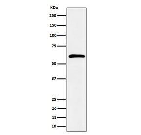Western blot testing of human K562 cell lysate with SDC3 antibody. Predicted molecular weight ~46 kDa but may be observed at higher molecular weights due to glycosylation.