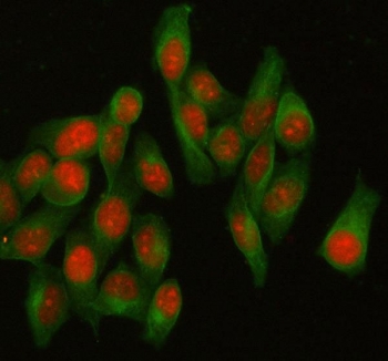 Immunofluorescent staining of FFPE human HeLa cells with HELLS antibody (red) and Beta Tubulin mAb (green). HIER: steam section in pH6 citrate buffer for 20 min.