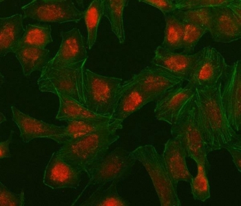 Immunofluorescent staining of FFPE human A549 cells with Interferon regulatory factor 5 antibody (red) and Phalloidin-AF488 (green). HIER: steam section in pH6 citrate buffer for 20 min.