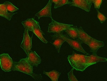 Immunofluorescent staining of FFPE human A549 cells with Interferon regulatory factor 4 antibody (red) and Phalloidin-iFluor 488 (green). HIER: steam section in pH6 citrate buffer for 20 min.
