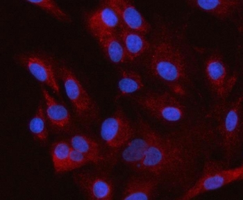 Immunofluorescent staining of FFPE human A549 cells with HSD3B7 antibody (red) and DAPI nuclear stain (blue). HIER: steam section in pH6 citrate buffer for 20 min.