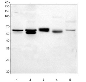 Western blot testing of 1) rat brain, 2) rat C6, 3) mouse eye, 4) mouse brain and 5) mouse Neuro-2a cell lysate with Best1 antibody. Predicted molecular weight ~64 kDa.