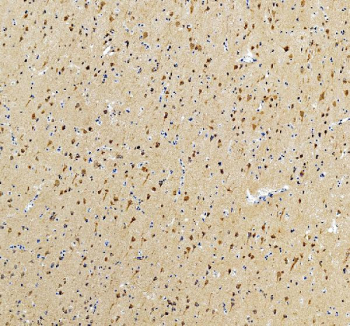 IHC staining of FFPE human brain tissue with Intersectin 1 antibody, HRP-secondary and DAB substrate. HIER: boil tissue sections in pH8 EDTA for 20 min and allow to cool before testing.