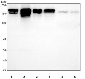 Western blot testing of 1) human HeLa, 2) human SiHa, 3) human A549, 4) human MCF7, 5) rat brain and 6) mouse brain with CLIP1 antibody. Predicted molecular weight: 156-162 kDa (multiple isoforms), commonly observed at ~170 kDa.