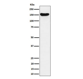 Western blot testing of human Jurkat cell lysate with VGL antibody. Predicted molecular weight ~141 kDa.
