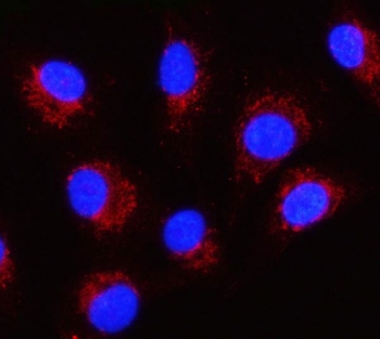 Immunofluorescent staining of FFPE human A549 cells with Serpin B8 antibody (red) and DAPI nuclear stain (blue). HIER: steam section in pH6 citrate buffer for 20 min.