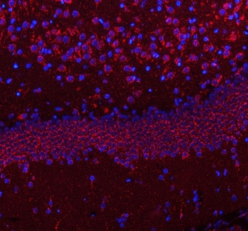 Immunofluorescent staining of FFPE rat brain tissue with HCRT antibody (red) and DAPI nuclear stain (blue). HIER: steam section in pH8 EDTA buffer for 20 min.