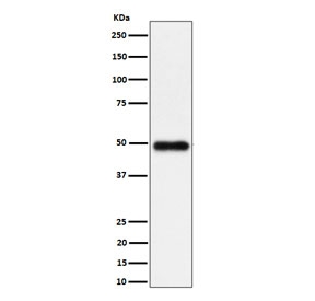 Western blot testing of human K562 cell lysate with NgR3 antibody. Predicted molecular weight ~49 kDa.