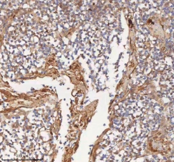 IHC staining of FFPE human tonsil tissue with MIPEP antibody. HIER: boil tissue sections in pH8 EDTA for 20 min and allow to cool before testing.