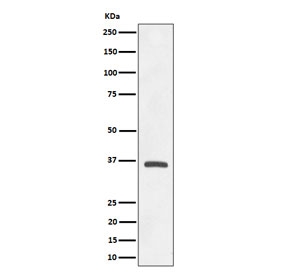 Western blot testing of human A549 cell lysate with OXGR1 antibody. Predicted molecular weight ~38 kDa.