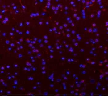 Immunofluorescent staining of FFPE rat brain tissue with Phosphoglucomutase 3 antibody (red) and DAPI nuclear stain (blue). HIER: steam section in pH8 EDTA buffer for 20 min.
