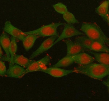 Immunofluorescent staining of FFPE human HeLa cells with Histone H1.10 antibody (red) and Beta Tubulin mAb (green). HIER: steam section in pH6 citrate buffer for 20 min.