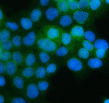 Immunofluorescent staining of FFPE human A431 cells with PGDH antibody (green) and DAPI nuclear stain (blue). HIER: steam section in pH6 citrate buffer for 20 min.