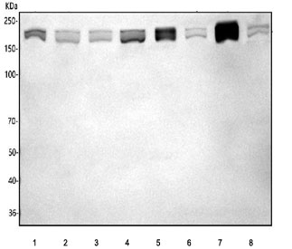 Western blot testing of 1) human A549, 2) human HEL, 3) human U-251, 4) human 293T, 5) rat testis, 6) rat brain, 7) mouse testis and 8) mouse brain tissue lysate with IFT172 antibody. Predicted molecular weight ~198 kDa, ~172 kDa and ~60 kDa (three isoforms).