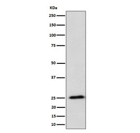 Western blot testing of human HeLa cell lysate with RPL10A antibody. Predicted molecular weight ~25 kDa.