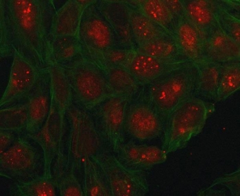 Immunofluorescent staining of FFPE human U-2 OS cells with PHC1 antibody (red) and DAPI nuclear stain (blue). HIER: steam section in pH6 citrate buffer for 20 min.
