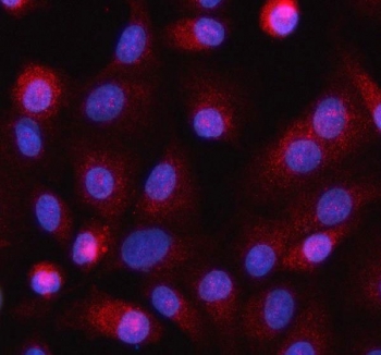 Immunofluorescent staining of FFPE human A549 cells with HELZ antibody (red) and DAPI nuclear stain (blue). HIER: steam section in pH6 citrate buffer for 20 min.