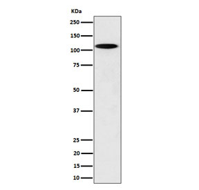 Western blot testing of rat PC-12 cell lysate with N4BP1 antibody. Predicted molecular weight ~100 kDa.