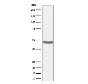 Western blot testing of human HeLa cell lysate with BCKDK antibody. Predicted molecular weight ~46 kDa.