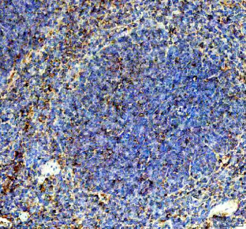 IHC staining of FFPE mouse spleen tissue with Cd244 antibody, HRP-secondary and DAB substrate. HIER: boil tissue sections in pH8 EDTA for 20 min and allow to cool before testing.