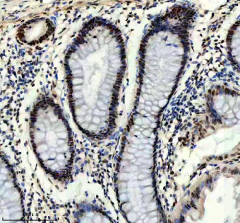 IHC staining of FFPE human colon tissue with Prospero homeobox protein 1 antibody, HRP-secondary and DAB substrate. HIER: boil tissue sections in pH8 EDTA for 20 min and allow to cool before testing.