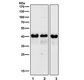 Western blot testing of 1) mouse brain, 2) mouse skin and 3) rat brain tissue lysate with TARDBP antibody. Predicted molecular weight ~45 kDa, commonly observed at 43-45 kDa.