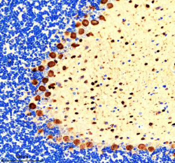 IHC staining of FFPE rat cerebellum tissue with PVALB antibody, HRP-secondary and DAB substrate. HIER: boil tissue sections in pH8 EDTA for 20 min and allow to cool before testing.