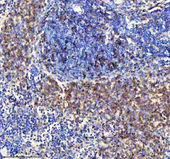 IHC staining of FFPE rat spleen tissue with CXCR5 antibody, HRP-secondary and DAB substrate. HIER: boil tissue sections in pH8 EDTA for 20 min and allow to cool before testing.
