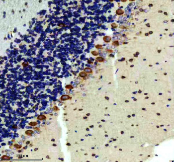 IHC staining of FFPE rat cerebellum tissue with RAPGEF4 antibody, HRP-secondary and DAB substrate. HIER: boil tissue sections in pH8 EDTA for 20 min and allow to cool before testing.