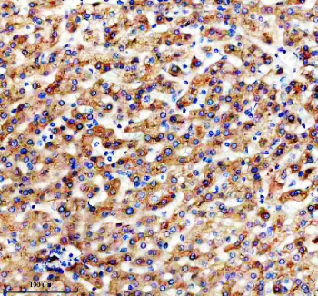 IHC staining of FFPE human liver tissue with Apolipoprotein H antibody, HRP-secondary and DAB substrate. HIER: boil tissue sections in pH8 EDTA for 20 min and allow to cool before testing.