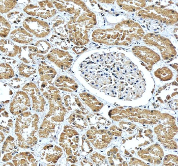 IHC staining of FFPE human kidney tissue with CBS antibody, HRP-secondary and DAB substrate. HIER: boil tissue sections in pH8 EDTA for 20 min and allow to cool before testing.