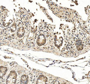 IHC staining of FFPE human small intestine tissue with Hephaestin antibody, HRP-secondary and DAB substrate. HIER: boil tissue sections in pH8 EDTA for 20 min and allow to cool before testing.