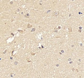 IHC staining of FFPE human brain tissue with Neurogenin 1 antibody, HRP-secondary and DAB substrate. HIER: boil tissue sections in pH8 EDTA for 20 min and allow to cool before testing.