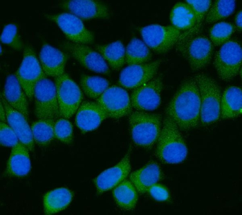 Immunofluorescent staining of FFPE human MCF7 cells with AP2M1 antibody (green) and DAPI nuclear stain (blue). HIER: steam section in pH6 citrate buffer for 20 min.