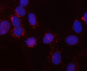 Immunofluorescent staining of FFPE human U-2 OS cells with SNX6 antibody (red) and DAPI nuclear stain (blue). HIER: steam section in pH6 citrate buffer for 20 min.