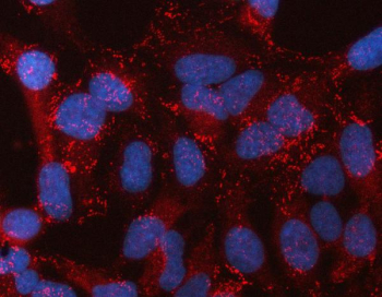 Immunofluorescent staining of FFPE human HeLa cells with STON2 antibody (red) and DAPI nuclear stain (blue). HIER: steam section in pH6 citrate buffer for 20 min.