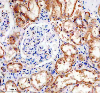 IHC staining of FFPE human kidney tissue with Phospho-Tau antibody, HRP-secondary and DAB substrate. HIER: boil tissue sections in pH8 EDTA for 20 min and allow to cool before testing.