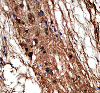 Immunohistochemical analysis of Lin9 protein using Lin9 antibody and paraffin-embedded zebrafish spinal cord tissue. HIER: boil tissue sections in pH8 EDTA for 20 min and allow to cool before testing.