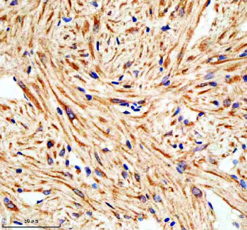 Immunohistochemical analysis of Lims1 protein using Zebrafish Lims1 antibody and paraffin-embedded zebrafish heart tissue. HIER: boil tissue sections in pH8 EDTA for 20 min and allow to cool before testing.
