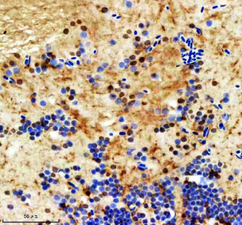 Immunohistochemical analysis of Ints12 protein using Zebrafish Ints12 antibody and paraffin-embedded zebrafish brain tissue. HIER: boil tissue sections in pH8 EDTA for 20 min and allow to cool before testing.